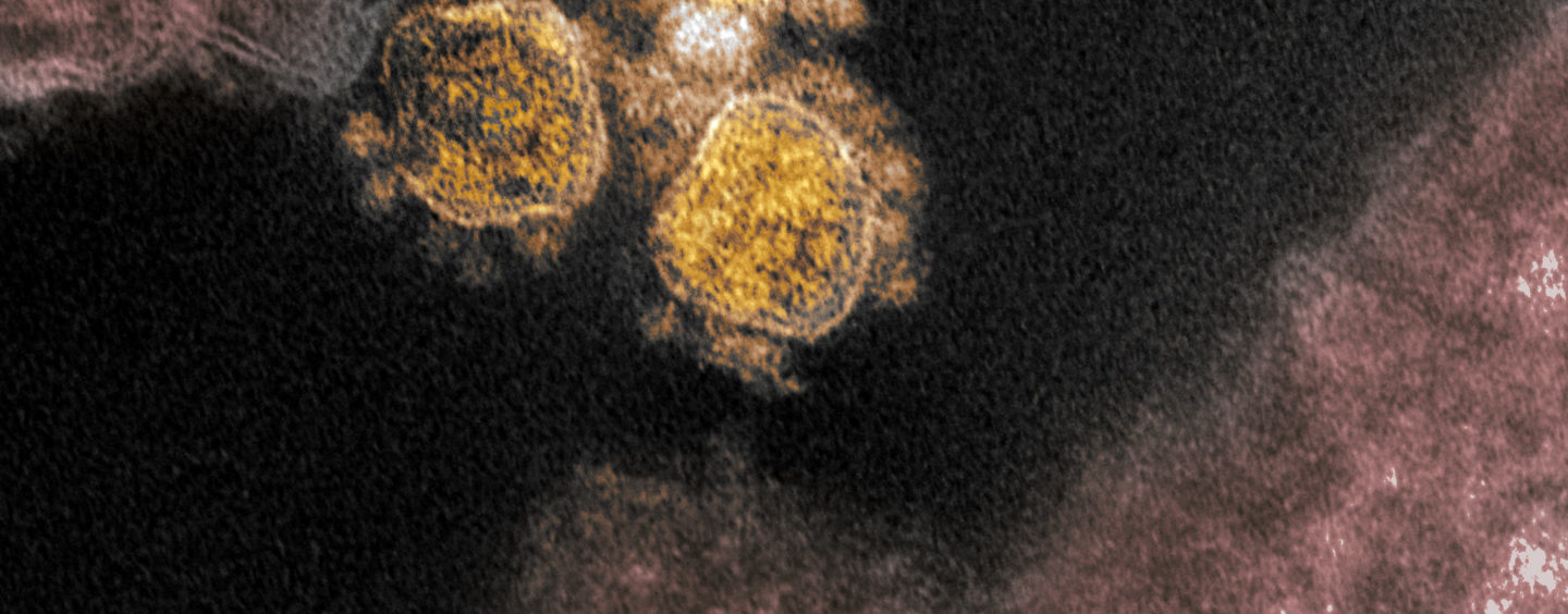 How to Stay Safe With a Fast-Spreading New Coronavirus Variant on the Loose